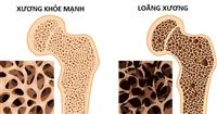 Vai trò của canxi đối với sức khoẻ